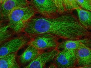 NCI Image